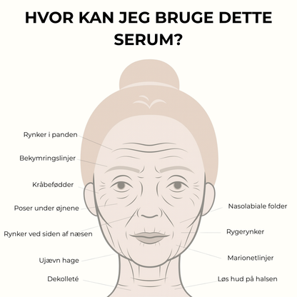 Mikro-Infusion Anti-Age Behandling™