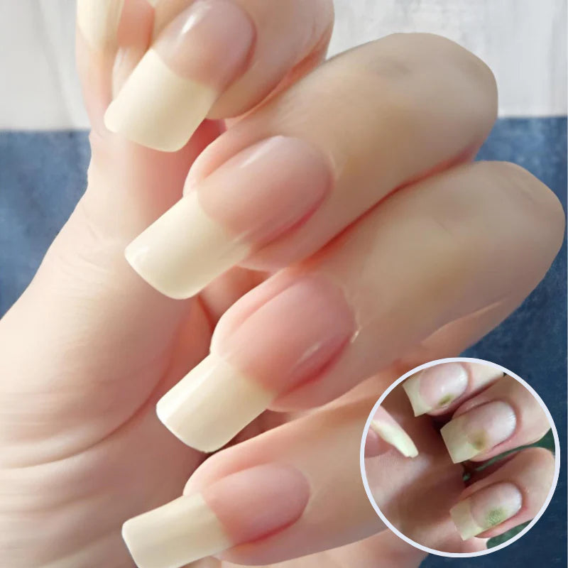 Antifungalt serum fjerner svamp